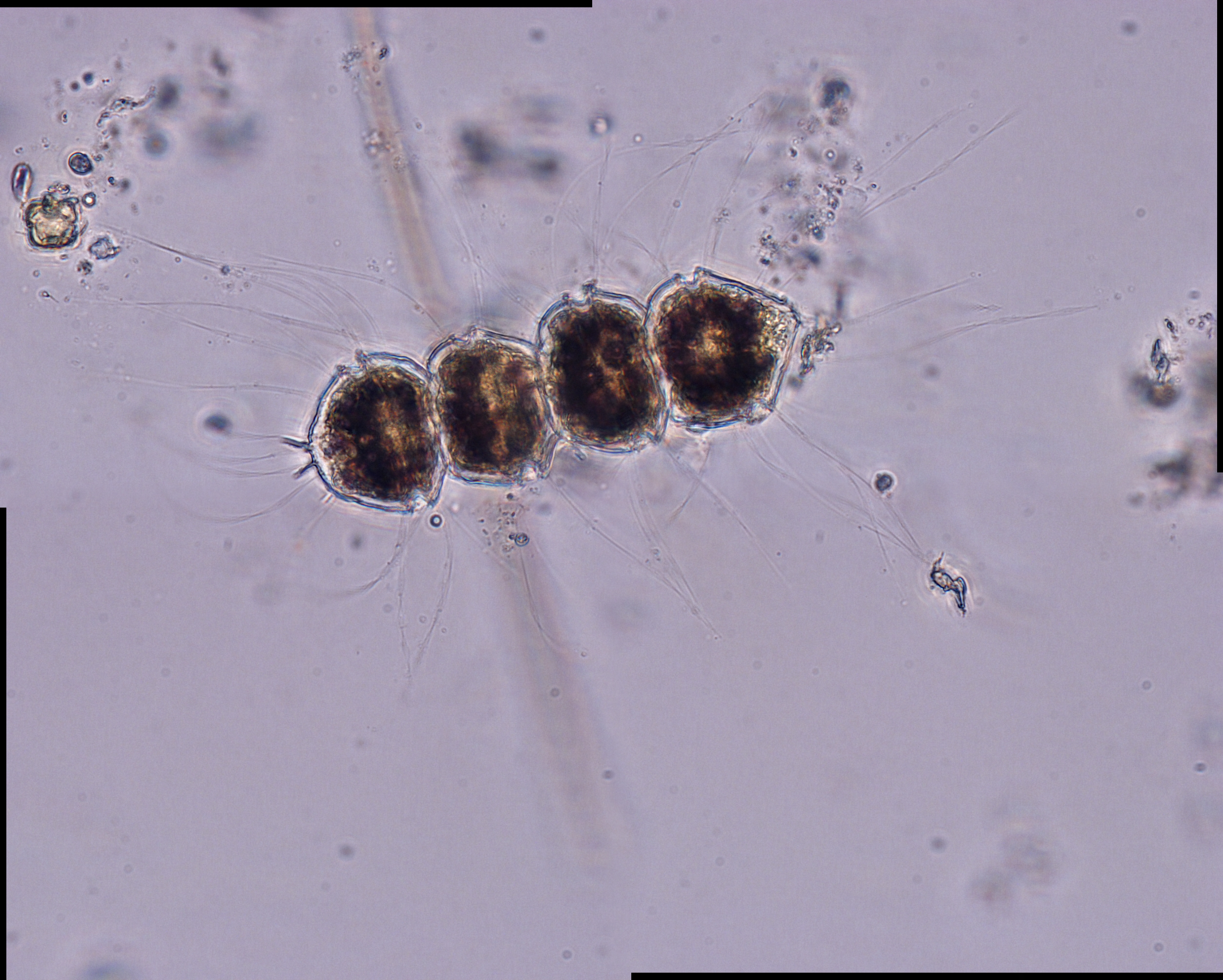 Dictyocha speculum